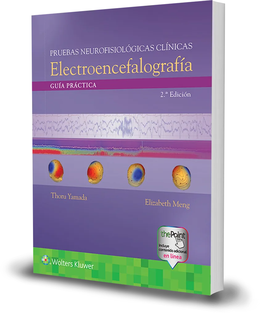 Pruebas neurofisiológicas clínicas. Electroencefalografía