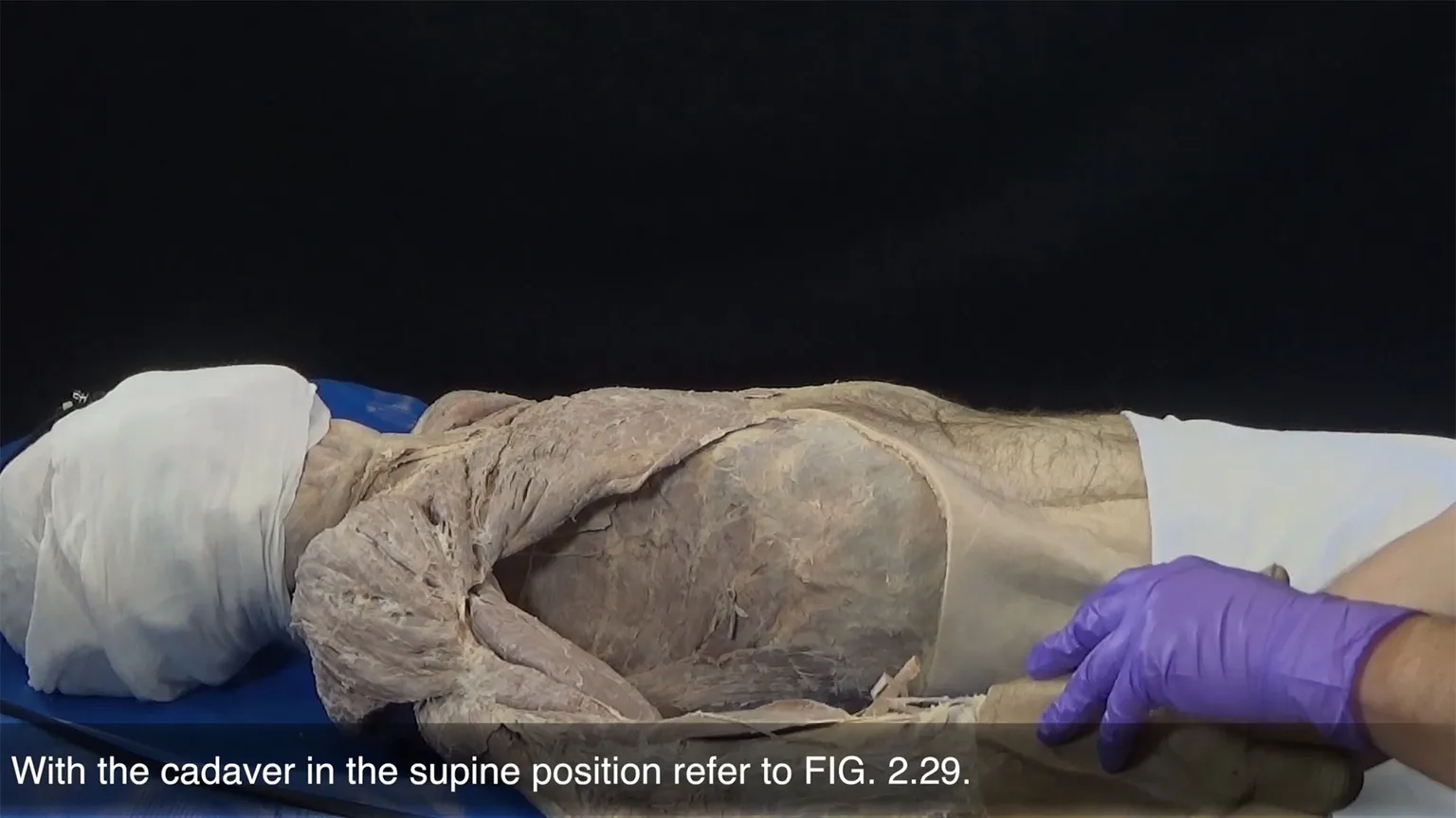 人体解剖実習 Grant's Dissection Videos 解剖実習のビジュアルガイド | Ovid