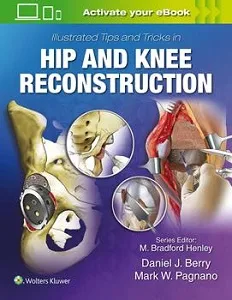 Illustrated Tips and Tricks in Hip and Knee Reconstruction book cover
